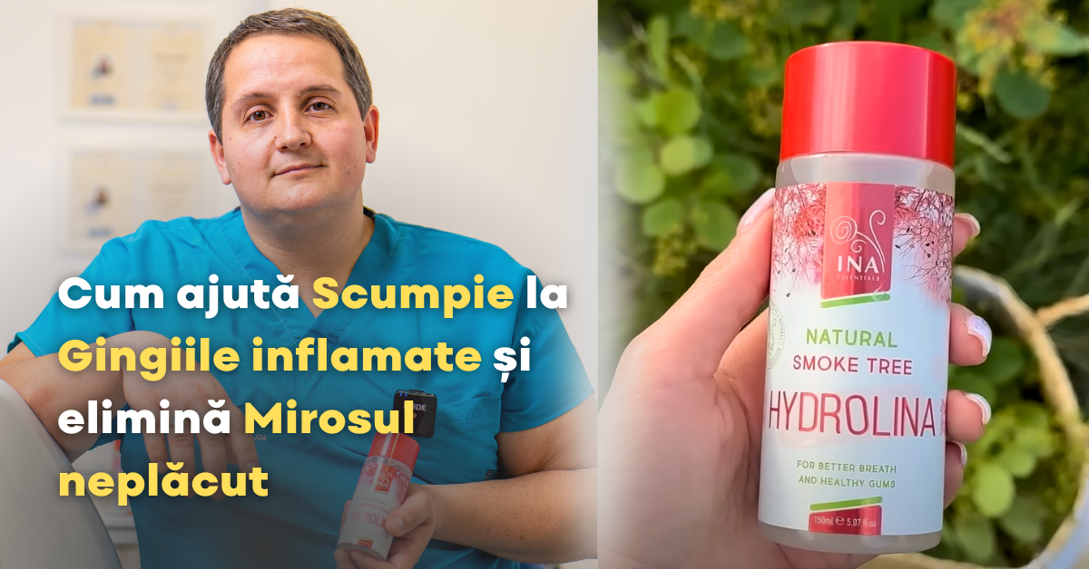 Cum poți scăpa de gingiile care sângerează și respirația urât mirositoare cu Apa de gura de Scumpie - Hydrolina?