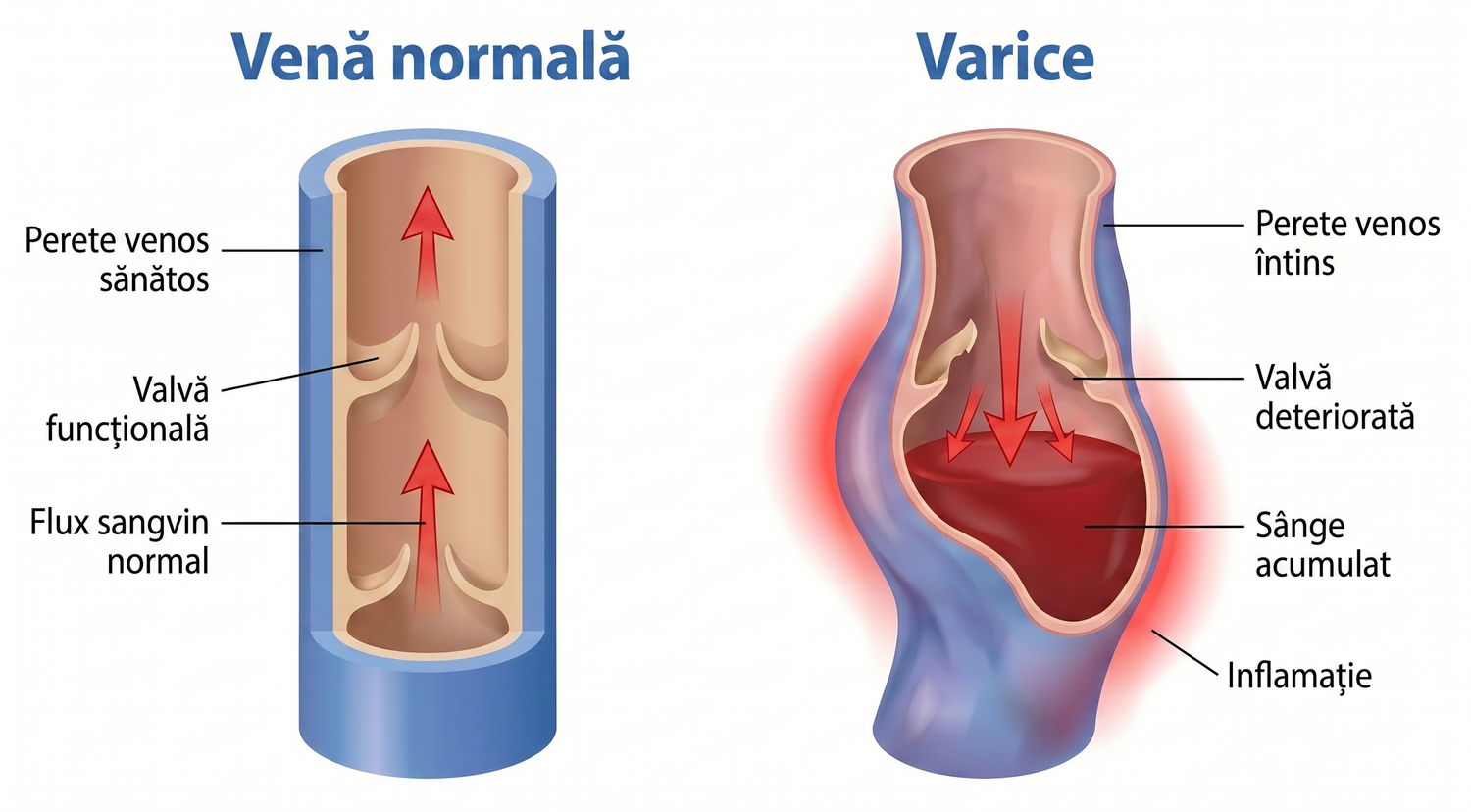 periodontis_ro